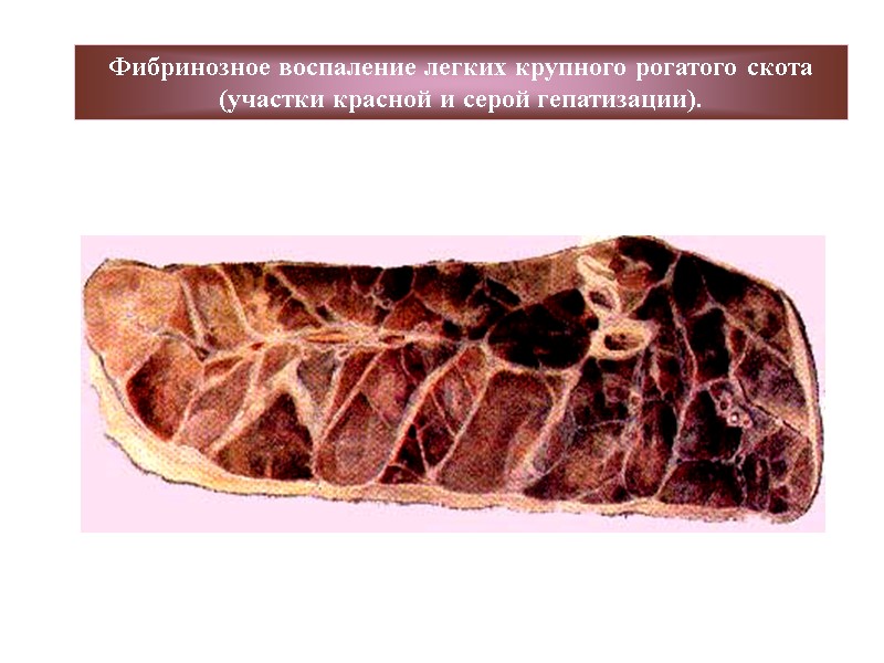 Фибринозное воспаление легких крупного рогатого скота (участки красной и серой гепатизации).